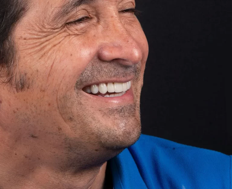 paciente de clínica dental mostrando un diseño de sonrisa.