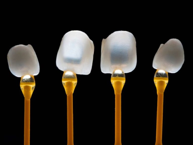 carillas dentales elaboradas por flujo digital