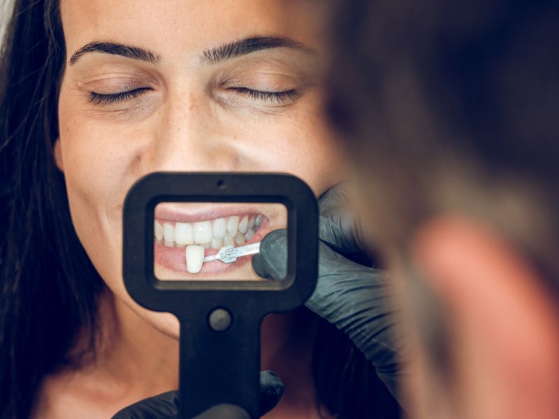 Odontólogo midiendo carillas dentales hechas con flujo digital a una paciente que muestra su dentadura sonriendo