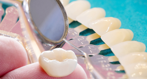 modelo de corona dental