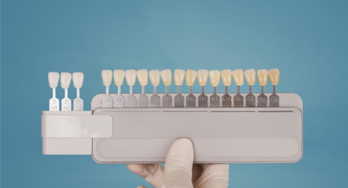 guía de sombra dental con tonalidades de dientes