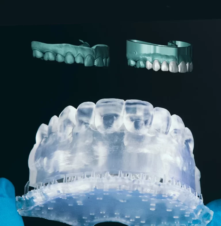 impresión_3D_estética_dental