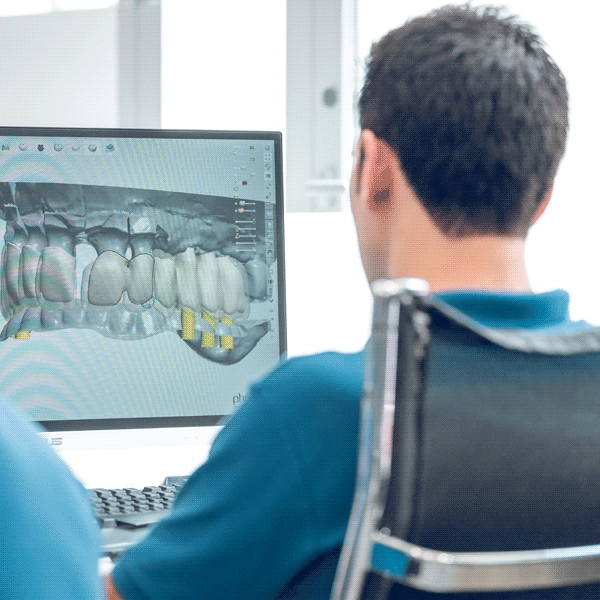 Implantes dentales guiados por computador